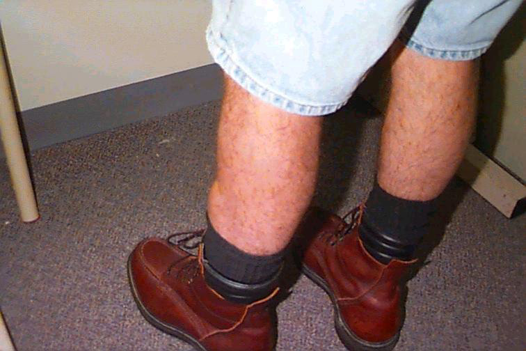 stop-feet-from-swelling-in-hot-weather-westfield-foot-and-ankle-llc