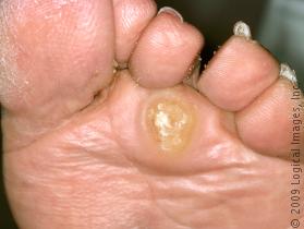 What's causing my feet to swell? - Almawi Limited The Holistic Clinic