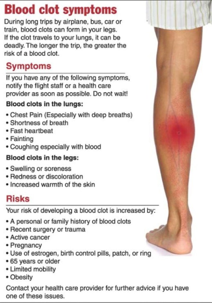 symptoms of dvt in leg