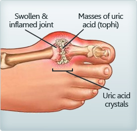 Dealing With Arthritis In The Knee - Almawi Limited The Holistic Clinic